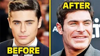 Top 10 Celebrities That Had 'Glow-Downs' According To Fans