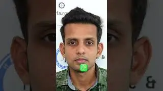 Grade 2 Hair Transplant Journey | 2435 Grafts I-FUE | HairFree & HairGrow Surat