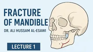 Fracture of mandible جراحة الفم/ الجزء الاول