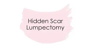 Hidden Scar Lumpectomy