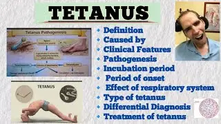 👉Tetanus (Lockjaw) Explained | 🔹Pathogenesis, Incubation Period, Types & Treatment | Exam Oriented 