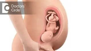 What is Low Lying Placenta & its causes? - Dr. Lalitha Sudha Alaparthi