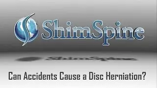 Can Accidents Cause a Disc Herniation?