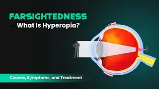 Farsightedness: What Is Hyperopia? Causes, Symptoms, and Treatment 3D