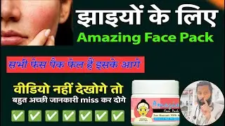Amazing Face Pack For Pigmentation ✨ Dr Prateek chauhan