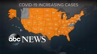COVID-19 cases rise in 45 states, deaths rise in 30 states