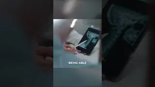 Иисус всё ещё исцеляет! Диск в шее растворился 🤯