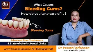 Bleeding Gums? Causes, Symptoms & Best Treatment Options | FMS Dental