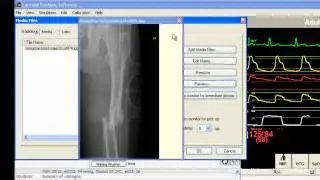 SimMan, SimBaby, SimNewB e ALS Simulator Guida Software - Parte 2 - Menu File