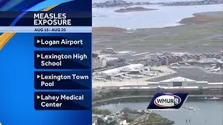 Mass. health officials warn of possible measles exposure at several Boston area locations