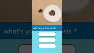 Dermoscopy quiz 2 #dermatology  #medstudent