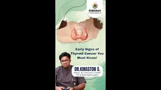 Early Signs of Thyroid Cancer You Must Know!