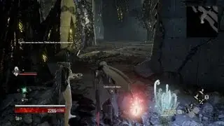 Whoops...