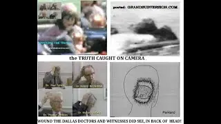 PRESIDENT JOHN F KENNEDY DEATH OF JFK AUTOPSY PHOTOS X-RAYS HEAD SHOT WOUND AND THE DALLAS DOCTORS.