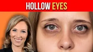 Tips for Hollow Eyes👀 | Dr. Janine