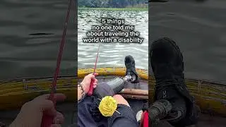 5 things no one told me before traveling the world as a below the knee amputee with a prosthetic leg