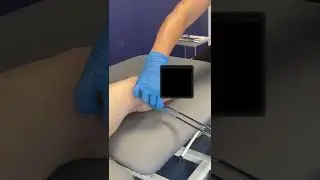 I&rsquo;m excited to share my journey of getting a fake toe 🤩 I can&rsquo;t wait to no longer feel pain!