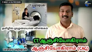 Coronary angiogram vs CT Angiogram in tamil | angiography | angioplasty | catheterization #pstamil