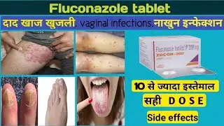 fluka 150 tablet - Fluconazole (150mg) medicine for fungal infection || दाद खाज खुजली की दवा