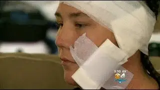 Victim Of Recalled Takata Airbag Speaks To CBS4