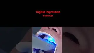 #digitaldentistry #dentalartistry #dentist #moderndentistry
