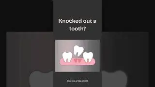 Knocked Out Tooth? Save It in 30 Minutes! #dentaltips #dentaleducation #knockout #toothcare #shorts