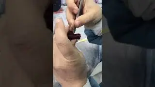 Maxillary 1st right molar (occlusal table carving)