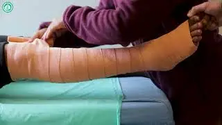 Compression Bandage for Varicose Veins