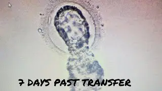 Frozen Embryo Transfer Update