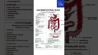 GI Bleed Explained with Signs & Management | পেটের রক্তক্ষরণের লক্ষণ ও চিকিৎসা #healthtipsyt #doctor