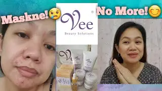 Vee Beauty Solutions Honest Review (GIVE AWAY! CLOSED)/Vee Beauty Solutions Clarifying Set Review