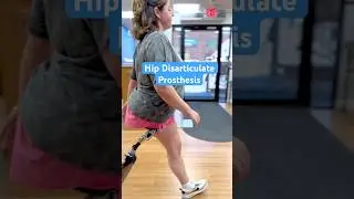Hip Disarticulation Amputee Haley Shows Natural Gait with Prosthesis