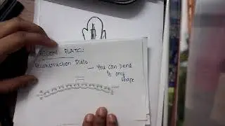 Reconstruction plate || Orthopedics
