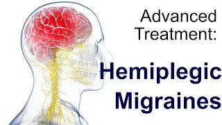 Hemiplegic Migraine Treatment