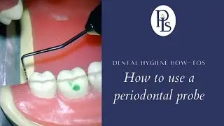 How to use a periodontal probe on a dental patient