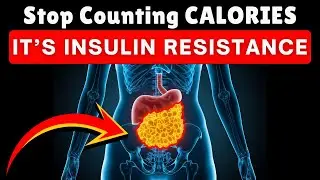 The Science of Hormonal Weight: It&rsquo;s Insulin Resistance Not Calories