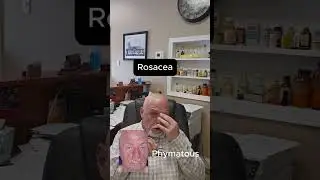 Rosacea #fyp #fypシ #medicine #medicineexplained #directprimarycare #directprimarycarephysician