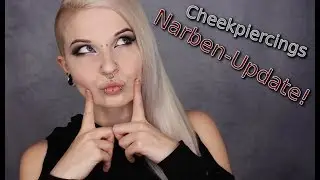 Cheekpiercings Narben-Update! | ❄ Lilith Whitic ❄