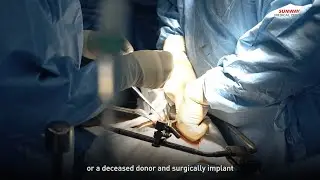 Common Questions About Kidney Transplant, Answered by Renal Transplant Specialist Dr Wong Hin Seng