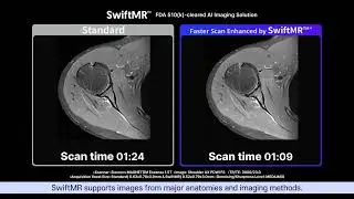 Introduction of SwiftMR / AI MRI Imaging solution by AIRS Medical