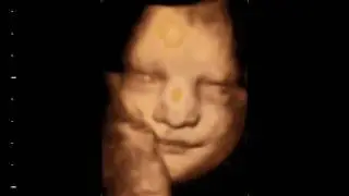 eyes wide open Beautiful 3D 4D baby bonding scan