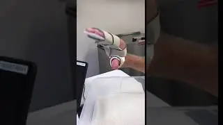 ULNAR NERVE WEAKNESS- Exercise with splint material