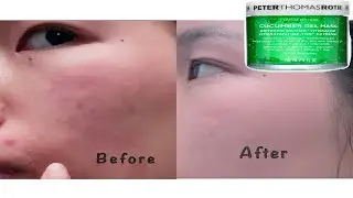 How to Calm Irritated Skin | Face Mask Review&Recommendation | Peter Thomas Roth Cucumber Gel Mask