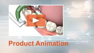Composi-Tight&reg; 3D Fusion&trade; Wide Prep ring placement