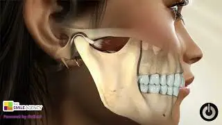 ✨ TMJ Occlusional Splint | Dr. Karen Guinn ✨