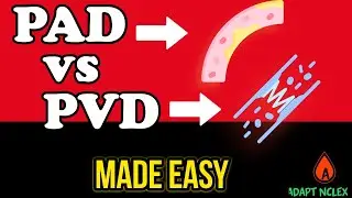 Peripheral Artery vs Venous Disease Made EASY + NCLEX Practice Questions