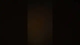 Loud Digestion tummy sounds