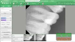 Ez Dent-i Program Программа  Ez Dent-i