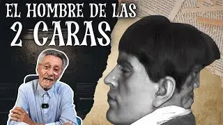 Edward Mordake: &iexcl;El hombre de las 2 caras!