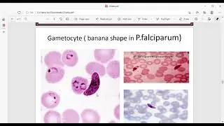 apicomplexa